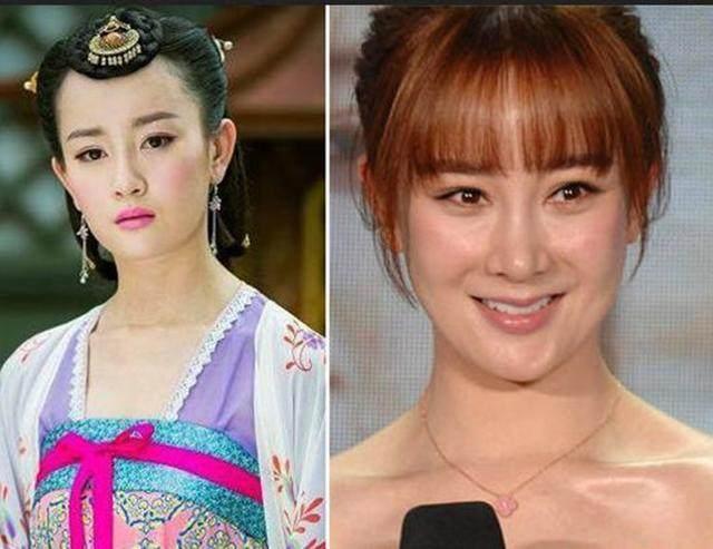 坦然面對整容，女明星的美麗新篇章之旅
