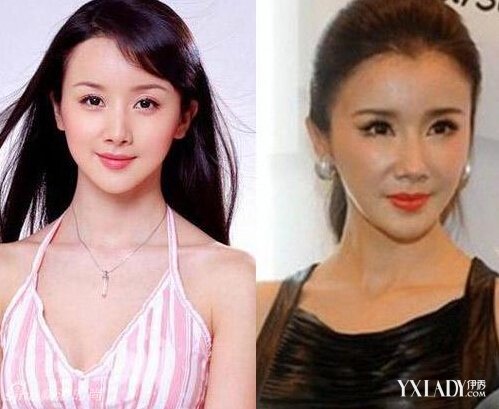 探秘明星整容的秘密，神秘美容小店的魅力所在！